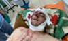 Раненого экс-мэра Конотопа отвезут в Киевский институт нейрохирургии