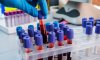 В Сумах готовятся проводить 150 тестов на коронавирус в сутки