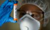 В Україні знижується захворюваність на ГРВІ, грип та коронавірус